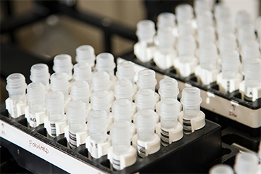 lab samples