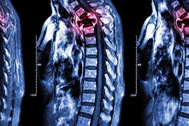colorful image of xray of spine