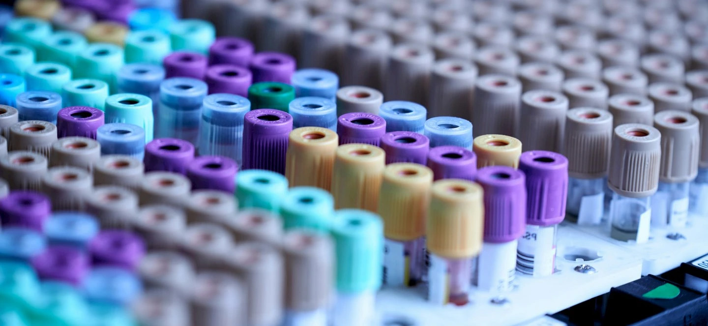 Multiple rows of colorful blood tests