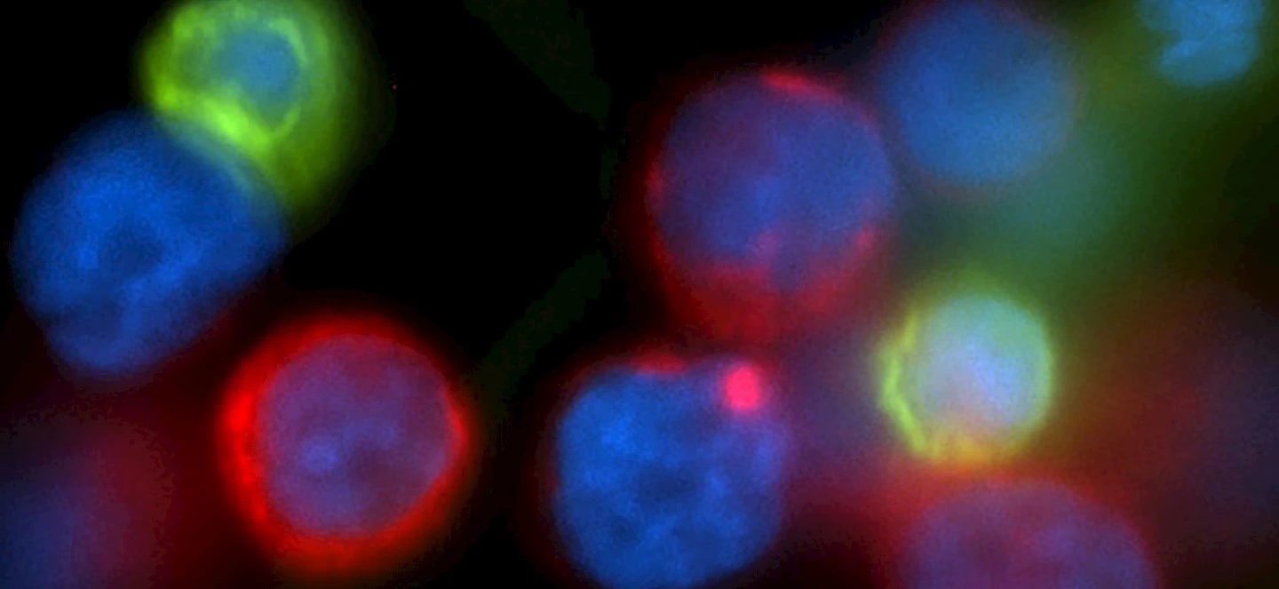 Fluorescent micrographs of cancer cells