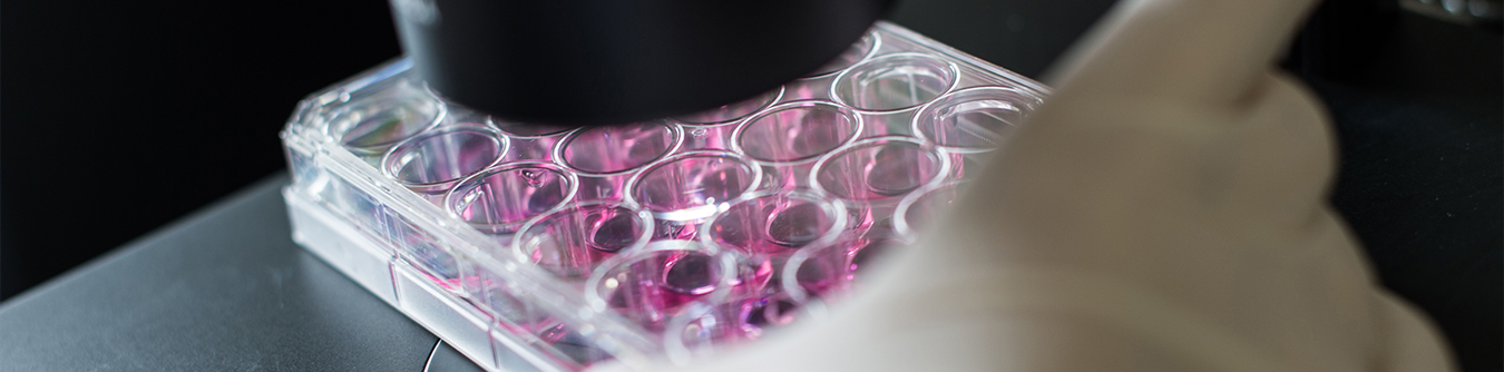 Someone holding test samples in a tray