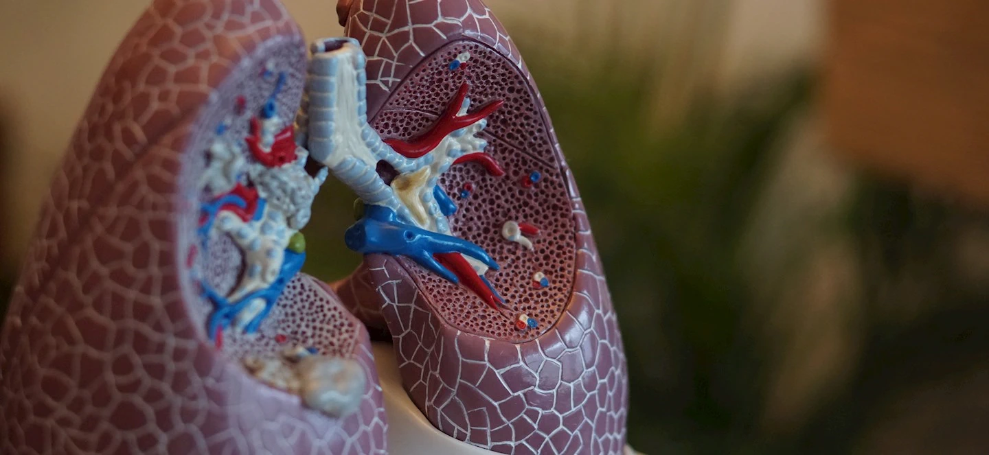 A model replica of lung anatomy