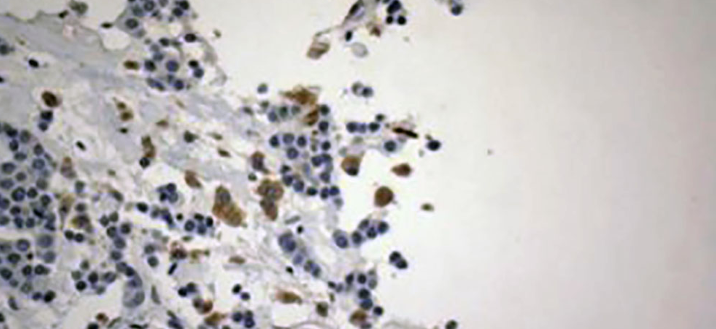 Cells under a microscope 