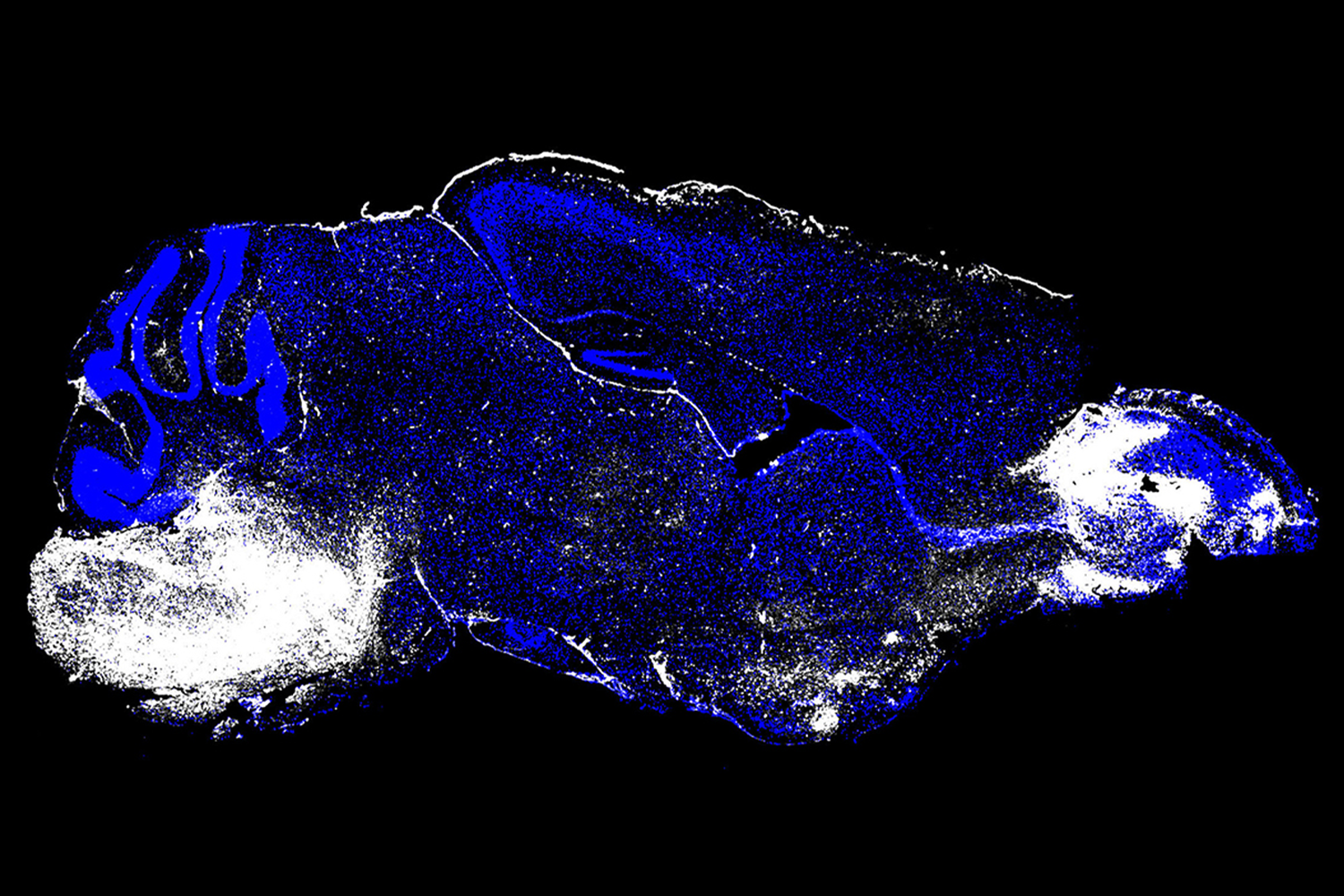 An imaged pancreas