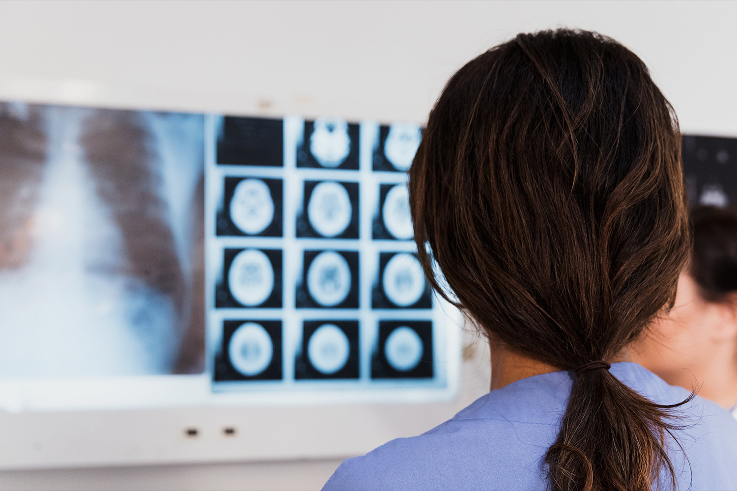 A person looking at multiple scan images
